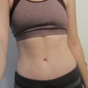 3 months post op