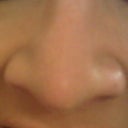 oct 2011 - looks wide and bulbous. doesnt even look like i had my nose worked on in 2007 and 2008
