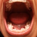 more of bottom teeth.with trays.