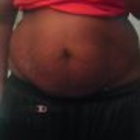 My tummy one week before surgery.  UGLY!!