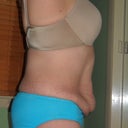 This is what happens when you have a 10 lb 12 oz baby and then lose 70 pounds.  This is not budging without the help of my surgeon!
