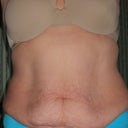 front view.  Going bye bye tomorrow!