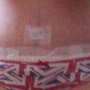 day 3 post-op