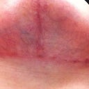 Week 7 Left T zone.  Same as right pretty much!
