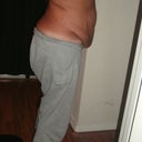 My ugly tummy now
