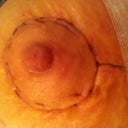 right nipple 10 days out
