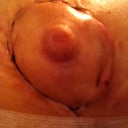 left nipple 10 days out