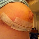 left side 10 days out