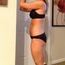 1 year from surgery
