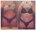 7wks vs 18wks....I have a large amount of gauze hidden on my left side but my right side still swells