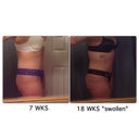 7wks vs 18 wks....yes I got a new tattoo...notice I have my curve has returned to my back & my swelling pools to the middle
