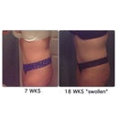 7wks vs 18wks....ahhhh swelling but still really happy :)