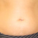 after zerona treatment
