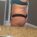Before OP  - Date Taken 11-1-12