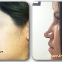 Profile. Improving :)