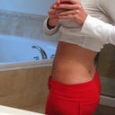 6 weeks post procedure
