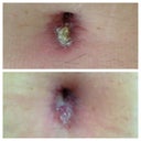 Before after I went to PS- yuck bb