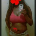 Me 3 months post op still swollen