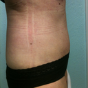 5wks side