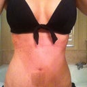 This is also 3 week post op. My belly button doesn't need tape anymore. It seems a little small to me, but I need to wait to all swelling is down to really see it.