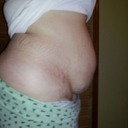Night Before surgery. 
I can't believe Im showing this!!!