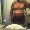 Day 1 post op