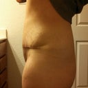 3 1/2 weeks left side after a long day of eating. Swollen. And flabby tuchas :)