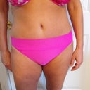 9 wks post op