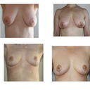Before and After!