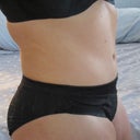 6 mo. PO side view
