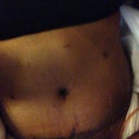 My new belly swollen though