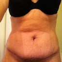 Week 5-Front