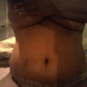 another after pic.. im very satisfied, i can just imagine what it will look like after the swelling go down... very happy