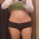 1 month post-op