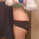 1 month post-op