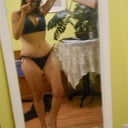 23 days post op