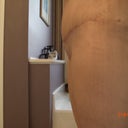 side view 3 weeks post op