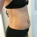Before - belly bulge