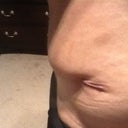 Right hip. Looks like a dog ear :-(