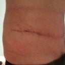 Left hip. Looks normal