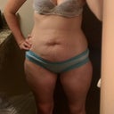 This is a quick photo I snapped the night before surgery.  I wish I had taken better before photos!