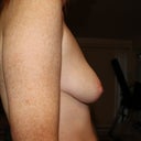 Right breast