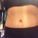 Front view 4 months Post op.