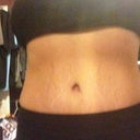 Front view 4 months post op.