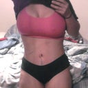post op day #7 i am alil swollen no more drains
