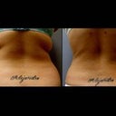I cannot believe the dramatic change!