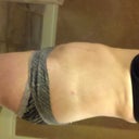 8 weeks post op