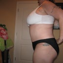 7 weeks post-op