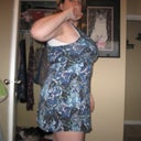 7 weeks post-op