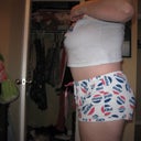 7 weeks post-op